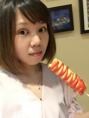 做了双眼皮多项整形手术，大家来看看果如何