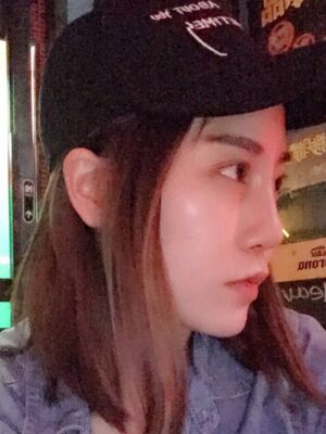 不想再打玻尿酸就去做了硅胶假体隆鼻