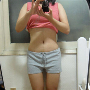 京韩做腰腹吸脂四个月的恢复照片，乔爱军医生的技术很好哦~