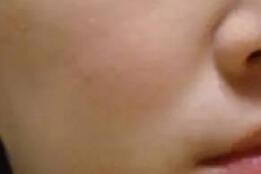 白瓷娃娃嫩白美肤前拍的照片,皮肤有些暗黄松弛