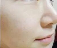 白瓷娃娃嫩肤美白果分享