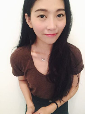 隆鼻手术前后过程对比图，真实案例分享