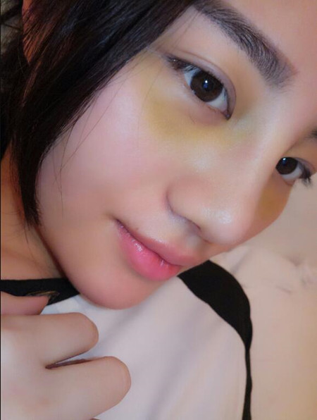 隆鼻整形手术拯救了我的低颜值