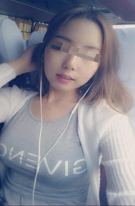 小胸和大胸就差一个李鸿君做的假体隆胸手术