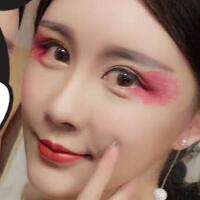 自体脂肪面部填充——丰太阳穴丰额头恢复过程真实案例分享