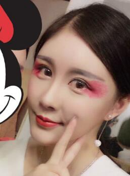 自体脂肪面部填充恢复图