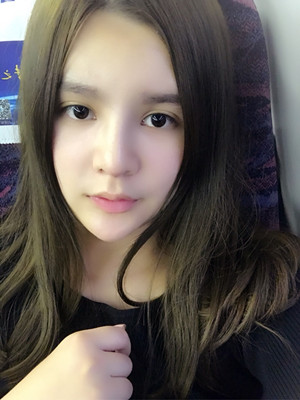 做完膨体隆鼻后脸型都变得好看了