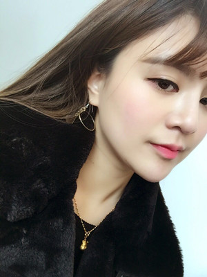 做完膨体隆鼻后脸型都变得好看了