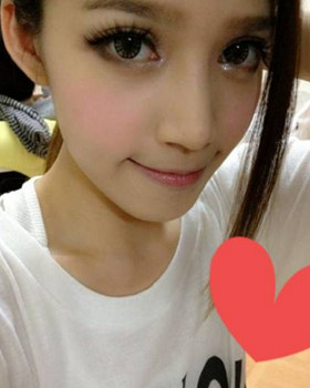 记录了隆鼻三个月前后的恢复过程，希望可以帮到有需要的朋友