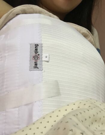 昆明丽都麦格假体隆胸正在恢复中~