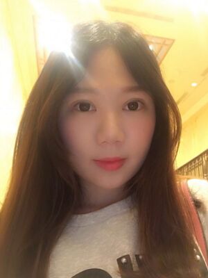 双眼皮失败修复拯救了我丑到哭的眼睛