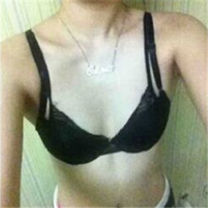 珠江医院做的自体脂肪隆胸手术，三个月了，有前后对比果图片哦~