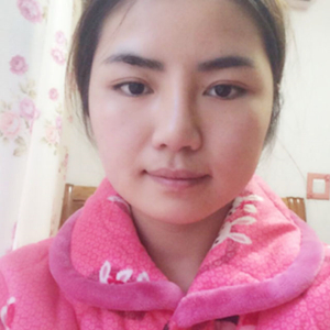 磨骨磨下颌角半年了，分享恢复过程和前后对比果照片哦~