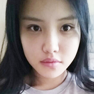 做下颌角整形手术半年了，给你们看看恢复过程照片吧~