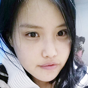 做下颌角整形手术半年了，给你们看看恢复过程照片吧~