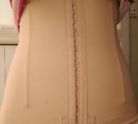 抽脂减肥瘦腰腹亲身经历和前后对比图分享