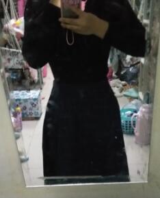 抽脂减肥瘦腰腹亲身经历和前后对比图案例分享