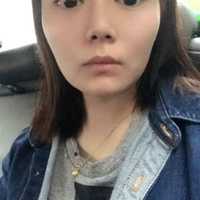 自体脂肪面部填充后年轻了好几岁呢