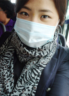 想做小V脸的看过来，给大家分享V脸手术的前后过程