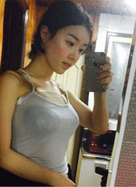 假体隆胸手术恢复过程分享，还有前后对比照片哦