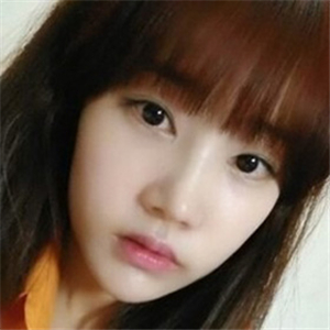 做地包天矫正手术五个月了，恢复得不错，有前后对比果图片哦~