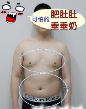 通过吸脂减肥逆袭成功的胖子