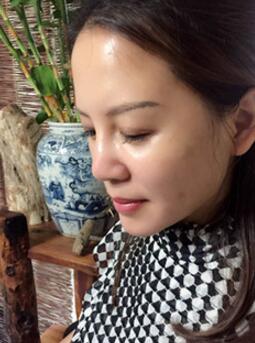 蛋白埋埋蛋白线.提升手术后恢复照片