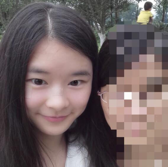 分享手术切除祛疤恢复过程希望对大家有帮助