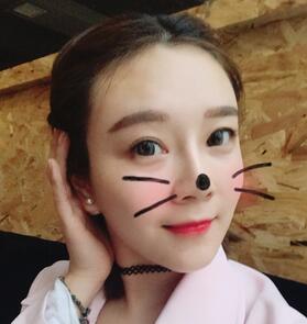 武汉中爱自体脂肪丰唇+面部填充恢复记录