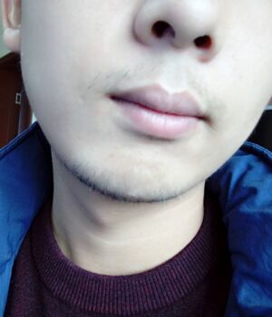 胡须种植后长出来的胡子较为满意