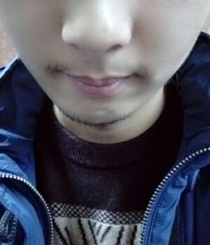 胡须种植后长出来的胡子较为满意