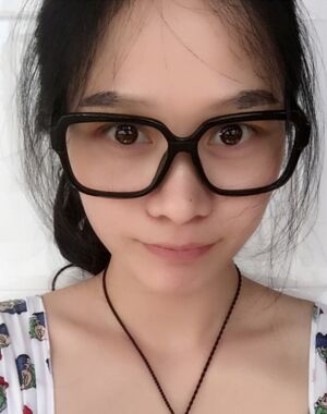 很淡的眉毛做完眉毛种植之后浓密多了