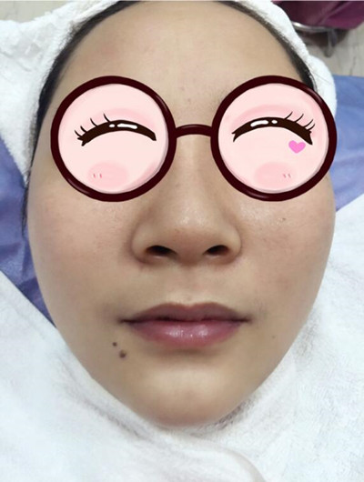 酷来围观我的水养嫩肤果怎么样