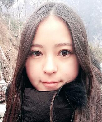 梨花雨割双眼皮恢复半年了