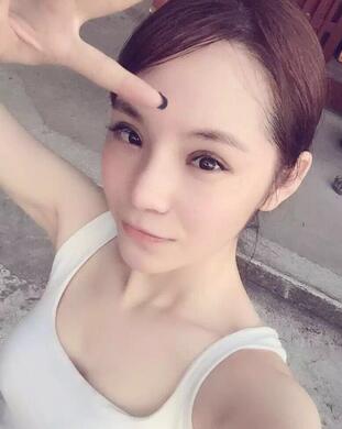 梨花雨隆鼻整形的恢复经历