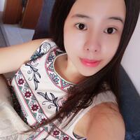 隆鼻整形真实恢复期图片 隆鼻整形一个月了