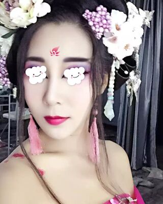 隆鼻失败修复后整给鼻形很精致，郑志敏医生做的