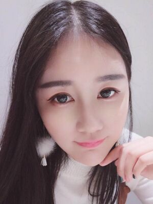 硅胶隆鼻+耳软骨垫鼻尖后美到朋友认不出