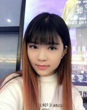 全切双眼皮修复后恢复成漂亮的眼睛了