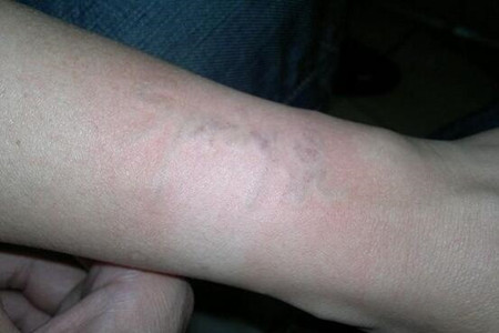 洗纹身还是要找一个靠谱的地方 快来看看我的果