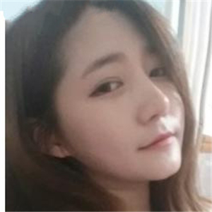 去年做的双眼皮，分享恢复过程和前后对比果图片~