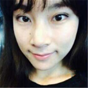 自体脂肪面部填充半年了， 皮肤好了，分享恢复照片哦~~