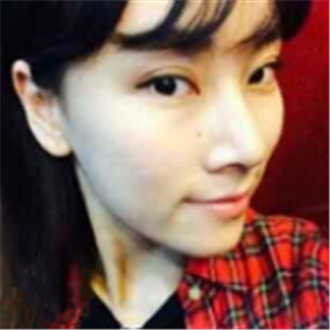 自体脂肪面部填充半年了， 皮肤好了，分享恢复照片哦~~