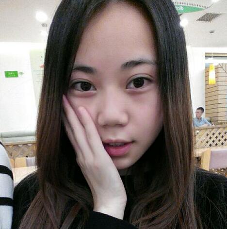 在厦门*菲做的激光祛疤过程分享