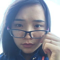 自体脂肪填充泪沟手术前后对比照片和恢复过程分享