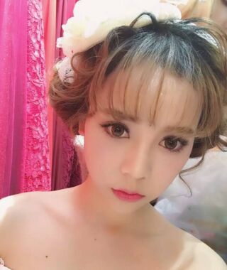 尹度龙医生做的双眼皮无比的自然美丽