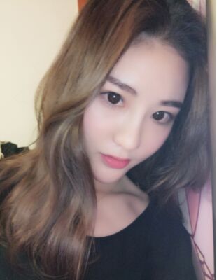 在隆鼻整形之后终于有了超精致的鼻子，尹度龙做的哟