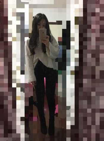 做了大腿吸脂手术 我的腿从大象腿变成蚂蚁腿