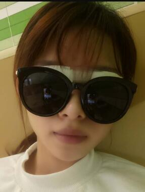 双眼皮伤口愈合