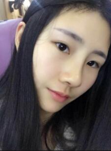 膨体隆鼻拆线两天了